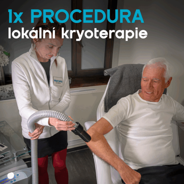 PROCEDURA lokální kryoterapie